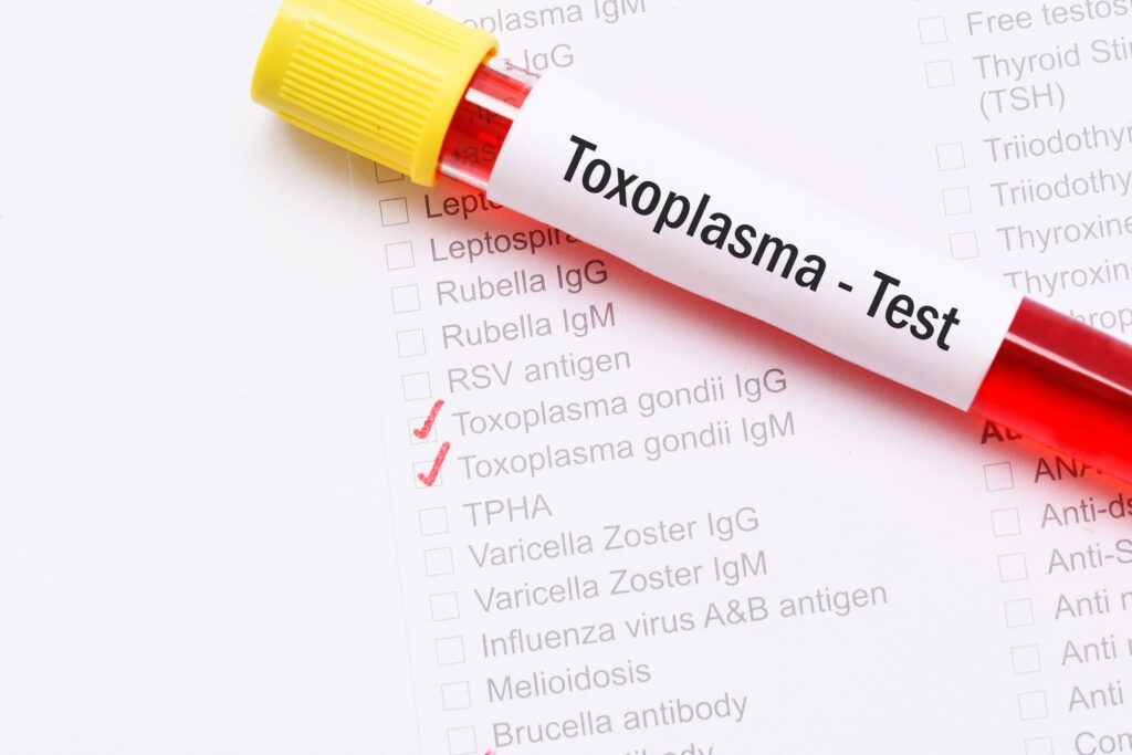 badanie na toksoplazmozę