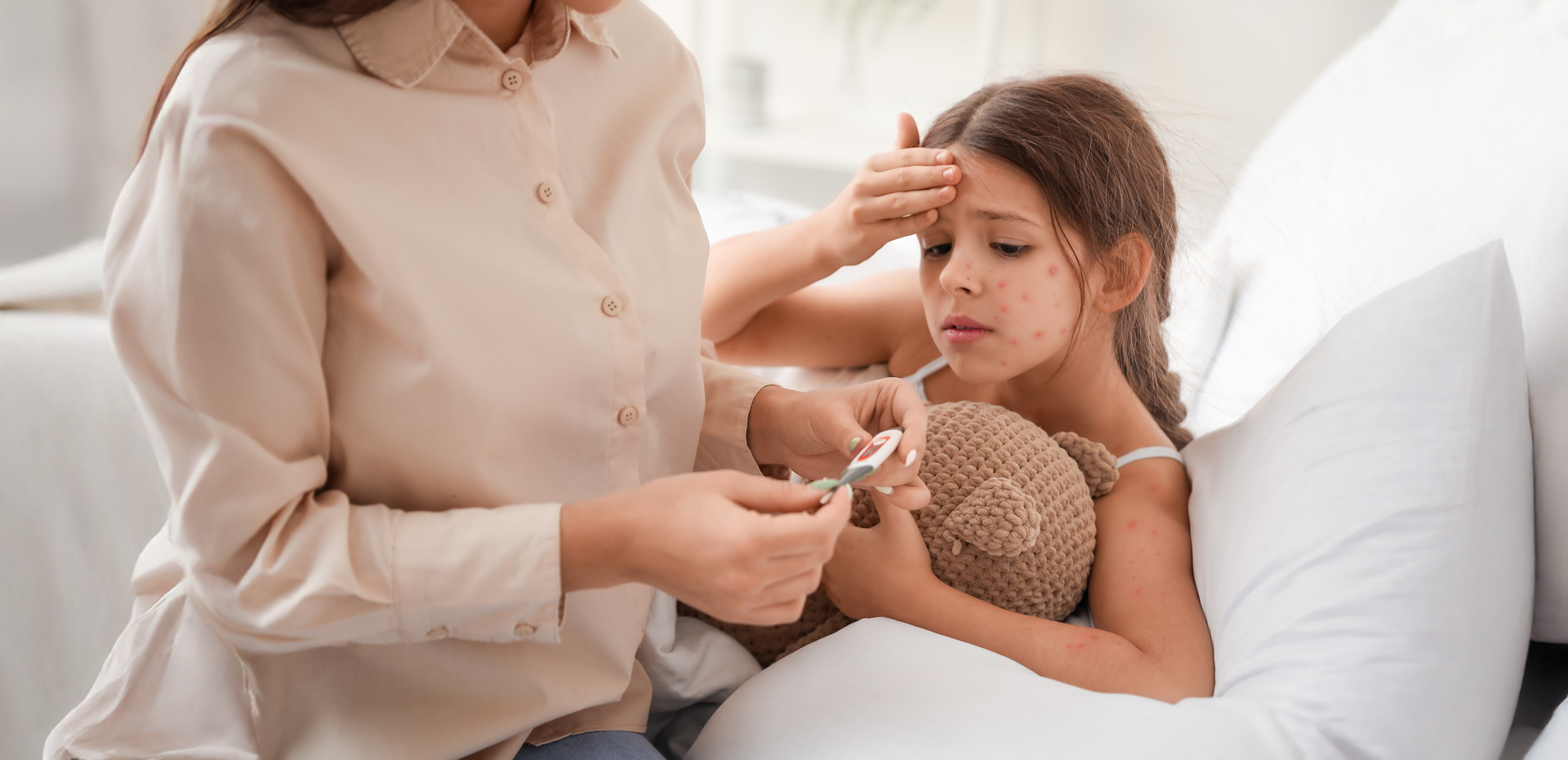 ospa przebieg choroby