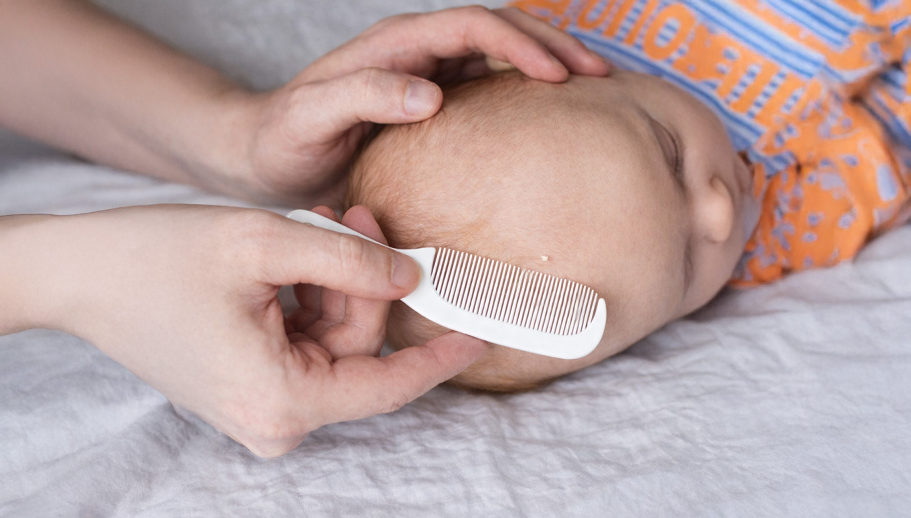 Kiedy ciemieniucha atakuje malucha